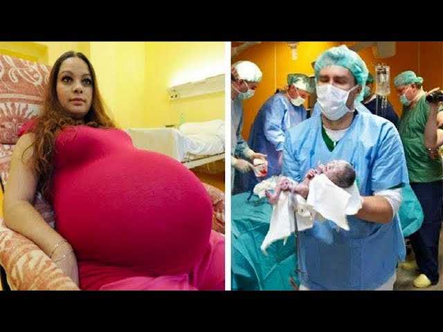 Девушка думала, что вынашивает 2  близнецов, но врачи заявили, что ее роды точно войдут в историю!
